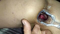 Exploring anal health with a dilator and speculum