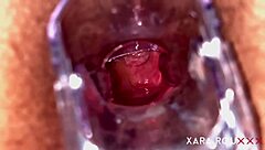 i'm using a speculum to show my gaping anal hole