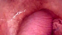 Delightful Sensation Of Powerful Water Jet Penetrating Deep Into My Tight Anal Opening