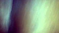 Doctor treats patient with chocolate glaze