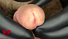 近景尿道扩张，业余群用三向扩张器